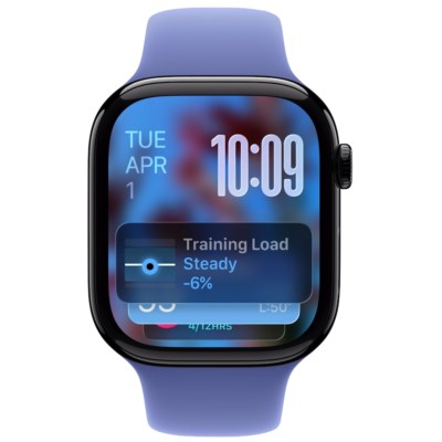 watchOS 26 ist das neue Gesicht der Apple Watch